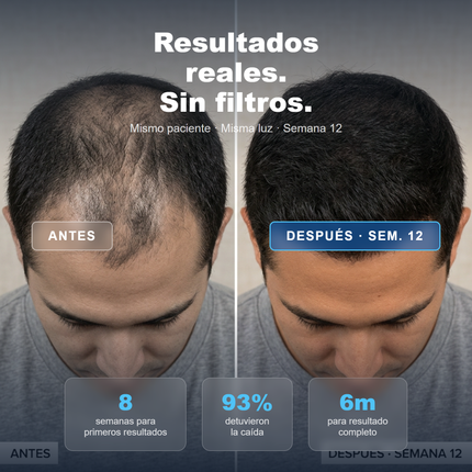 ELLOS™ Cabello Para el DHT. Finasteride + Minoxidil + Biotina. Recupera tu cabello hoy.