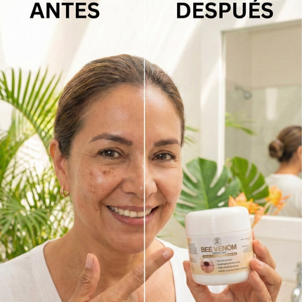 Crema de Veneno de Abeja Alivio Natural del Dolor en Articulaciones