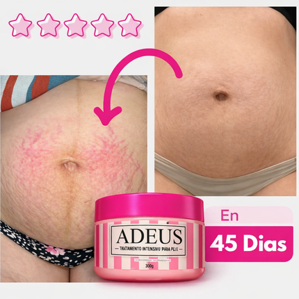 Crema ADEUS™: Reafirma, Hidrata y Combate Estrías.