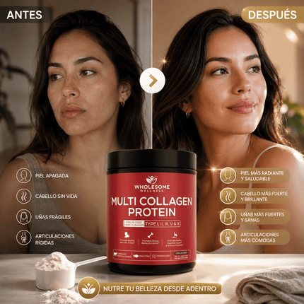 MULTICOLLAGEN PROTEIN™ 5 Tipos de Colágeno para Piel, Cabello, Uñas y Articulaciones, empieza hoy!!