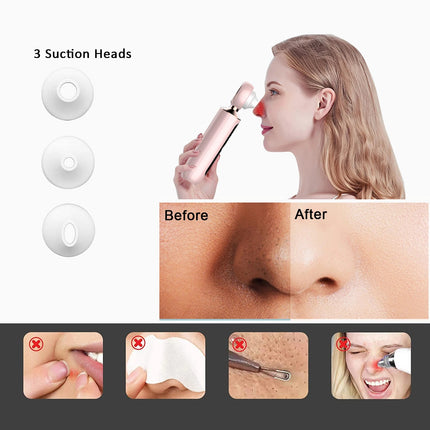 Removedor de Puntos Negros