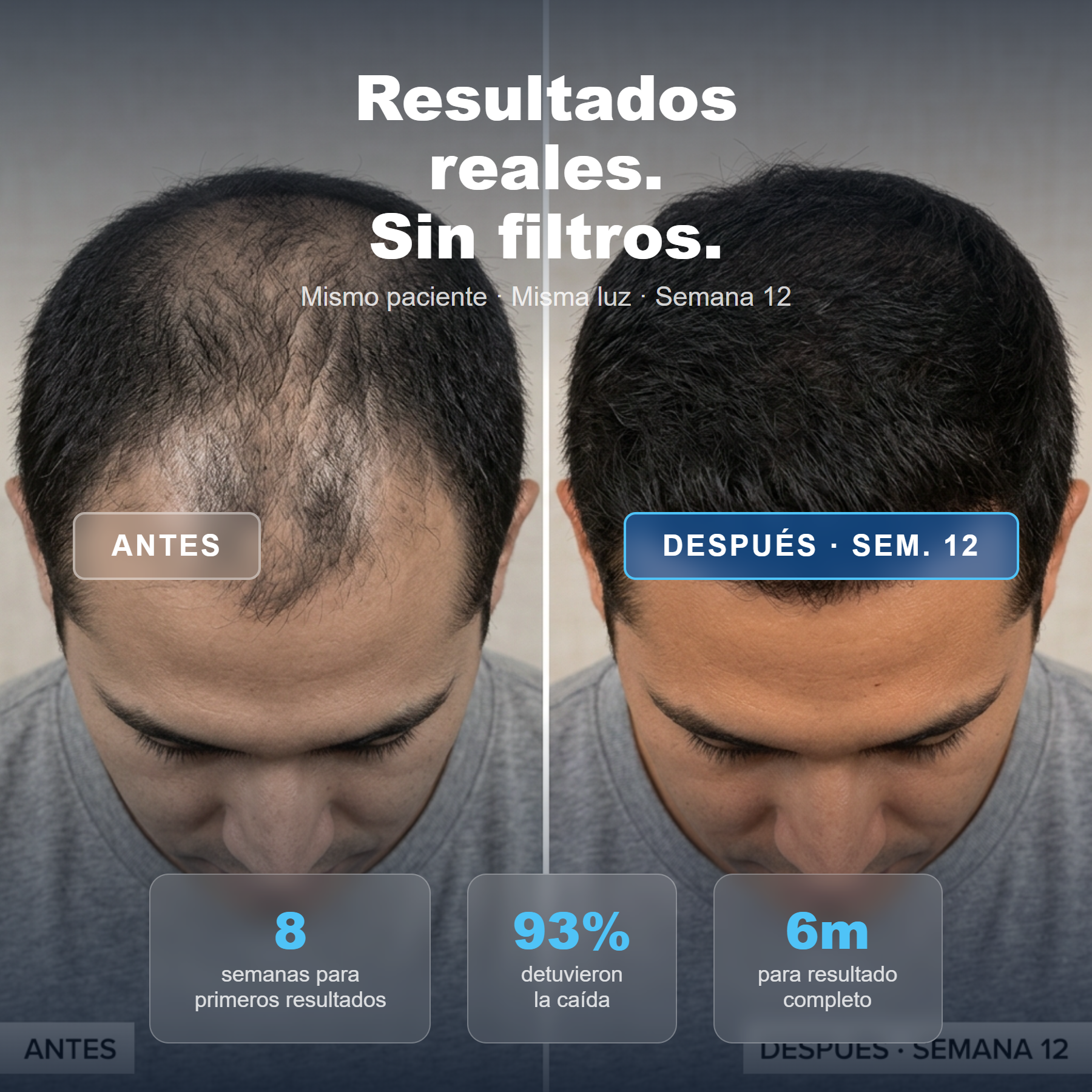 ELLOS Cabello — 06 resultados